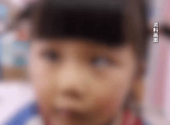 5岁女童沉迷手机变斗鸡眼，医生提醒儿童过度用眼危害大
